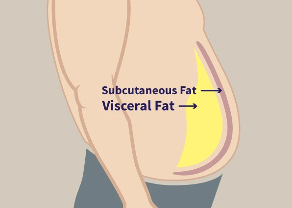 O que fazer para reduzir a gordura abdominal